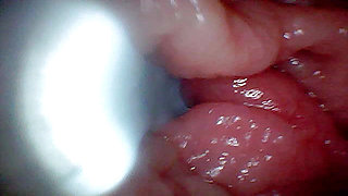 First time: An endoscope reveals the G-spot up close - without mountingl