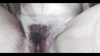 My Anus Is Pale? I Don't Know What Happened