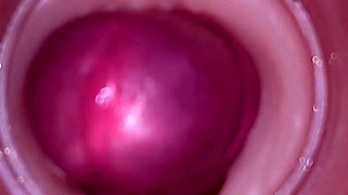 Female Insemination - Internal Camera Captures Deep Male Ejaculation