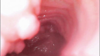 Endoscope Creampie. Cam Inside Pussy Shows Dick Cumming Inside Pussy