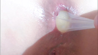 Assholegap Gaping Analstretch Analplay