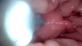 Teen POV: Endoscope G-Spot Close-Up – First Time Deep Pussy Exam