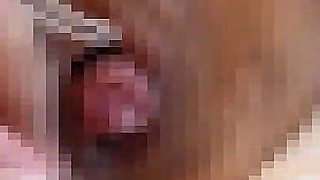 I Aspirate M Woman Clitoris and Am Fixed with Rubber