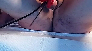 Pisshole Checkup