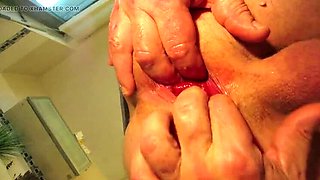 German Couple Stephanovitsch Anal Prolapse Fisting - Big Ass Doggy Style