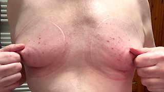 Slapping, sucking, torturing my titties!